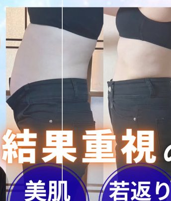 ビフォーアフター｜温活痩身でボディラインの変化（効果には個人差があります）